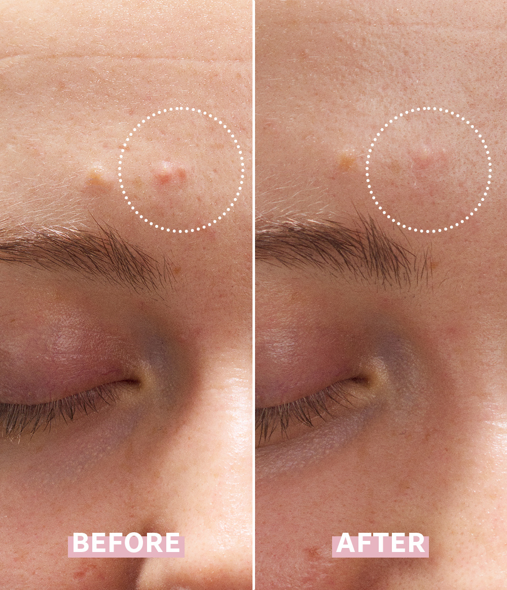 OH MY CICA SPOT GEL CREAM